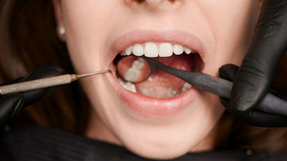 Regularne kontrole u dentysty pozwalają wcześnie wykryć choroby zębów.